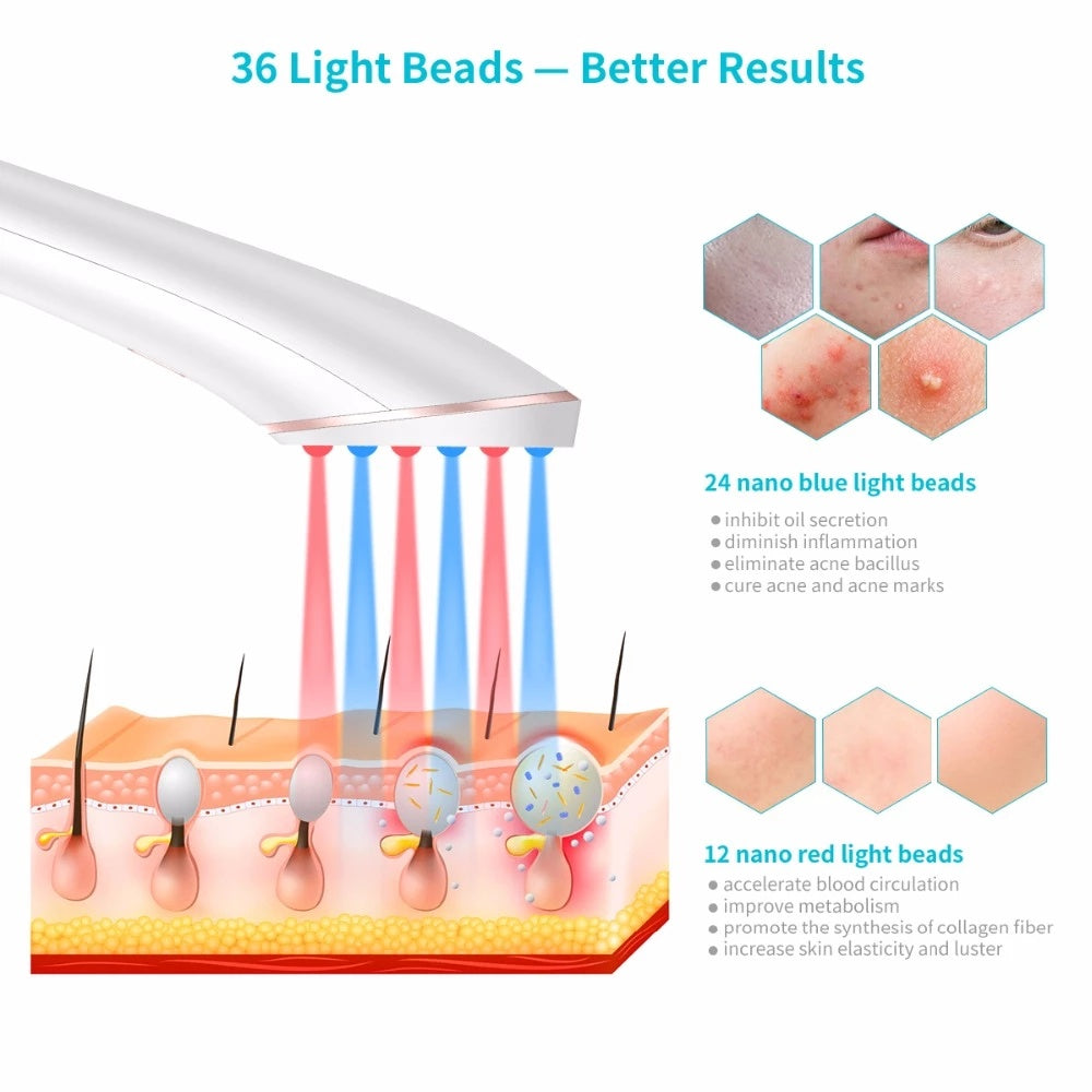 Xpreen Wireless Acne Light Therapy Device